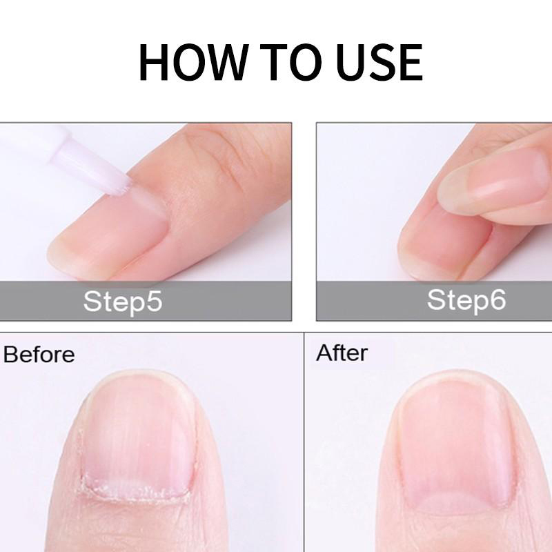 กรรไกรตัดหนังกำพร้าแบบมืออาชีพ - Tech Accessories Products บทวิจารณ์และราคา